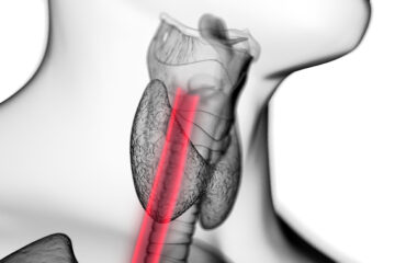 Difficulty Swallowing and Eosinophilic Esophagitis EoE