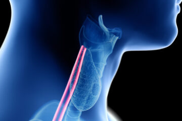 Difficulty Swallowing and Eosinophilic Esophagitis EoE