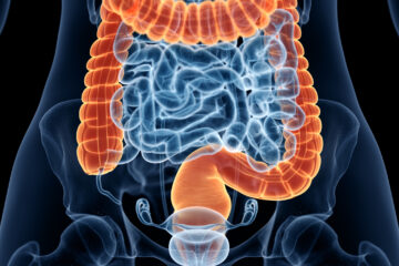 Ulcerative Colitis EBGCR Clinical Research